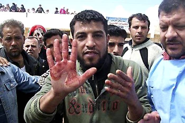 2011. An anti-government activist raises a bloody hand during a funeral procession for a demonstrator killed in protests against the Syrian regime on 23rd April 2011. Just one of thousands of victims. The struggle continues