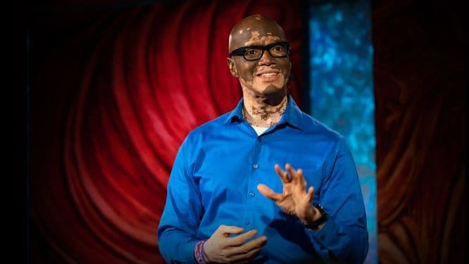 Lee Thomas is the author of the book Turning White: A Memoir of Change (a book which highlights his mental and emotional struggles with Vitiligo).