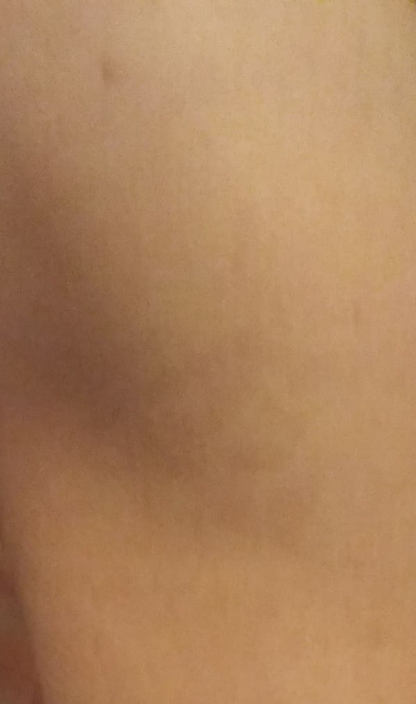 If you have the scar for Small pox you are protected. Usually on the left arm. The vaccine was stopped in 1972, if you where born after, you are not protected.