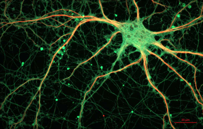The central nervous system cannot work at 100% sensitivity all the time. Pictured: a rat's hippocampal neuron.