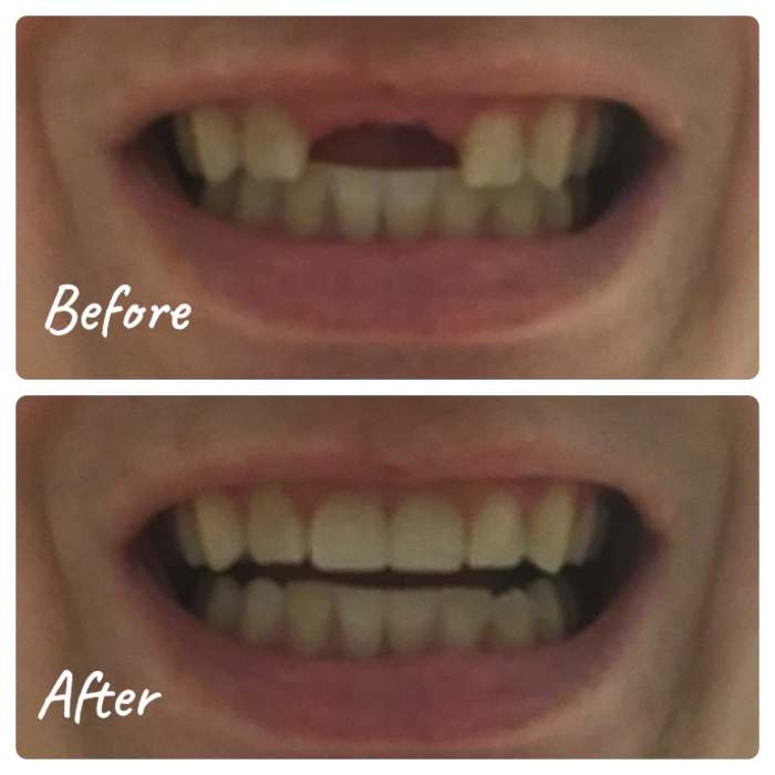 Review of Dental Lab Direct My Experience Patient's Lounge