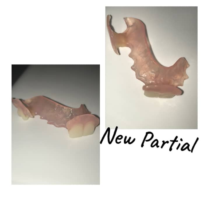 Review of Dental Lab Direct My Experience Patient's Lounge