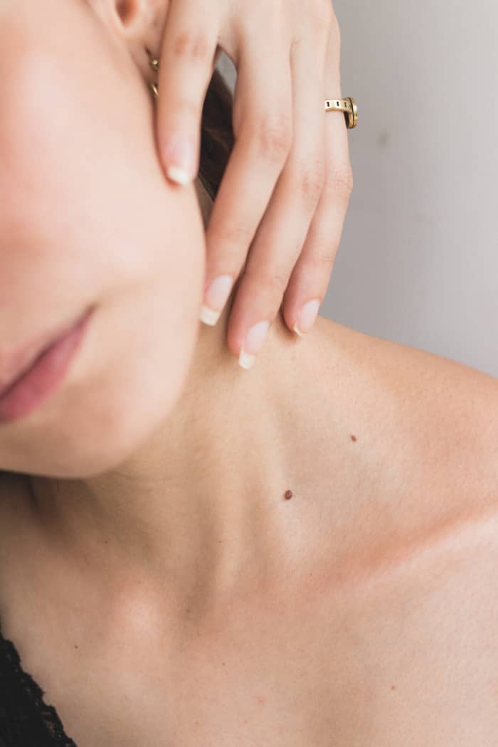 Does prosacea work? Clear skin is a struggle for those with rosacea.