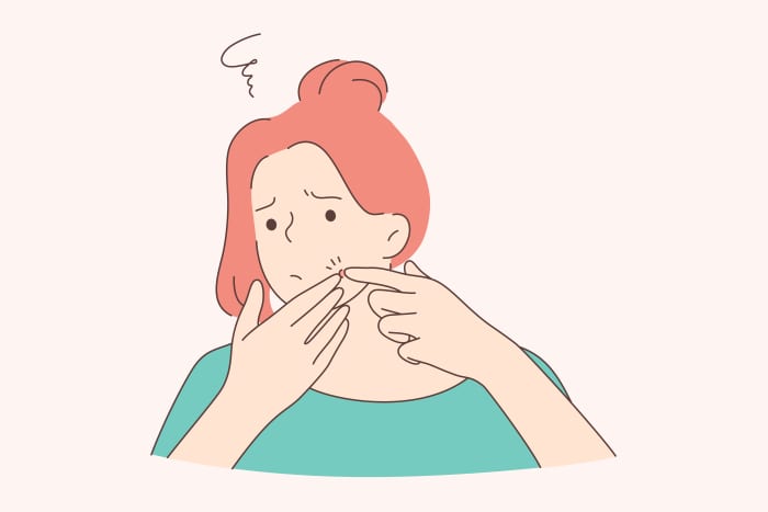 Hormonal acne may take many forms, including whiteheads, blackheads, and the deeper, redder, cystic eruptions commonly seen along the jawline.