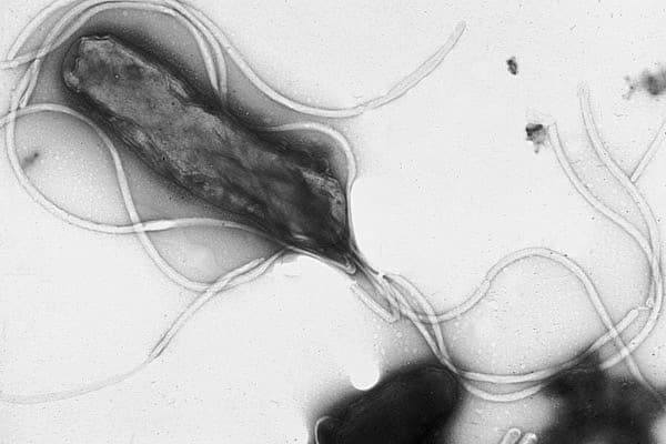 Helicobacter pylori is the cause of many stomach ulcers.