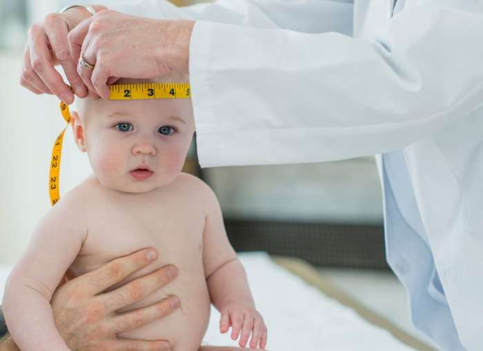 Flat Head Syndrome in Babies Why Are We Seeing More of It? WeHaveKids