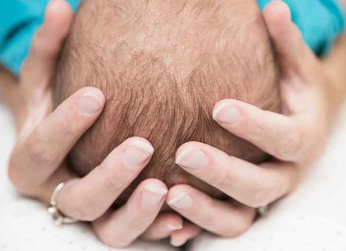 Flat Head Syndrome in Babies Why Are We Seeing More of It? WeHaveKids