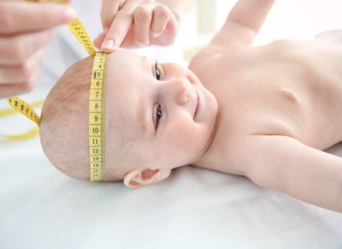 Flat Head Syndrome in Babies Why Are We Seeing More of It? WeHaveKids