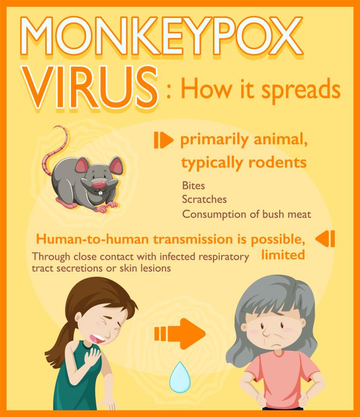 Understanding Monkeypox (Mpox): Symptoms, Causes, and Treatment ...