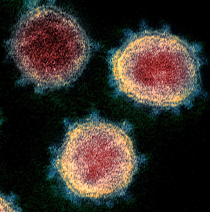What SARS-CoV-2 looks like when viewed through a transmission electron microscope (TEM). This virus is responsible for causing COVID-19. Coronaviruses get their name from the “corona” or “crown” of spikes that line the edges of the viral particle.