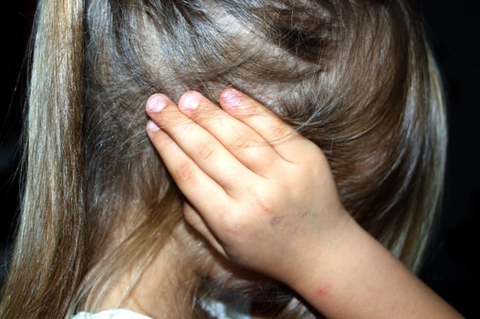 A child covering her ears due to noisy surroundings.
