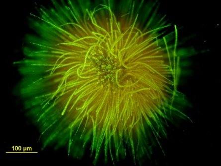 A close up of Cyanobacteria courtesy of the United States Geographic Survey - photo by Barry H. Rosen, USGS