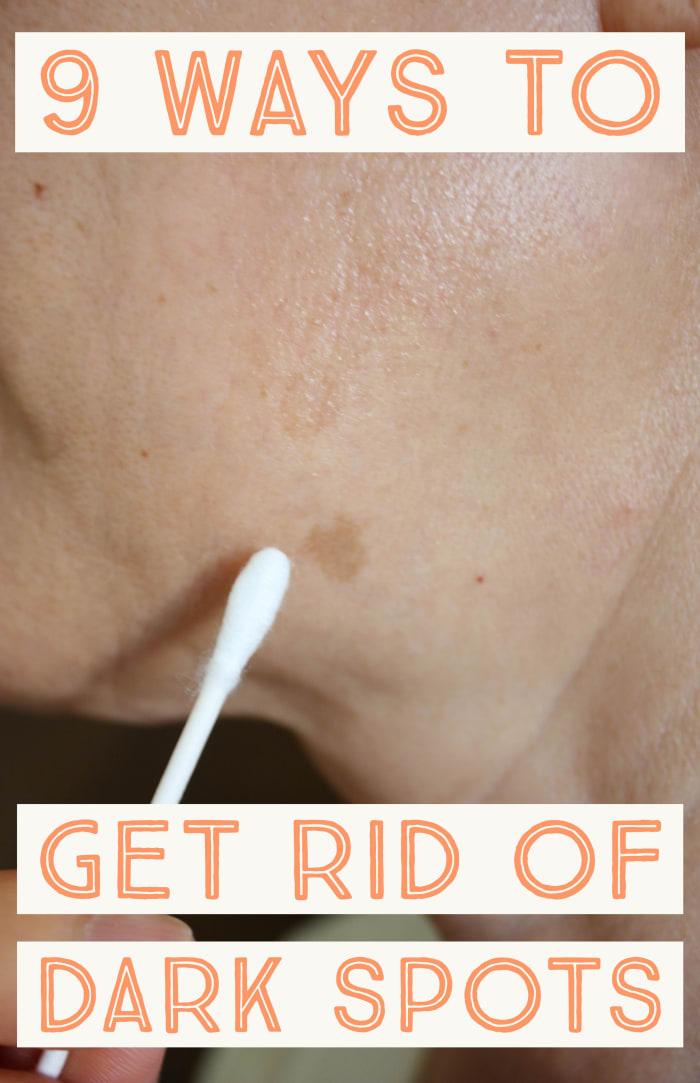 Oto jak pozbyć się ciemnych plam.'s how to get rid of dark spots. 