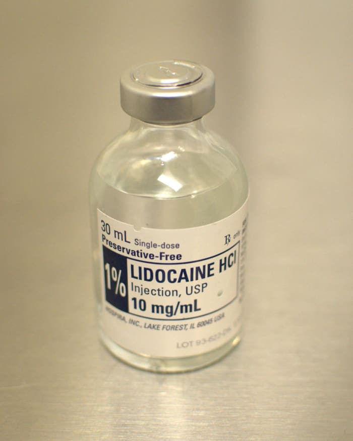 Lidocaine is a commonly used local anesthetic