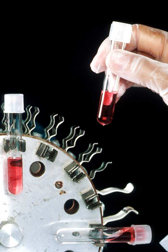 A spinning device used to mix cell culture media: biotech companies use these devices to grow cancer cells for research.