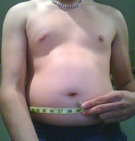 Bloated Stomach - This person clearly has blockage somewhere and has had for awhile. He could benefit from a good hydrocolonic.