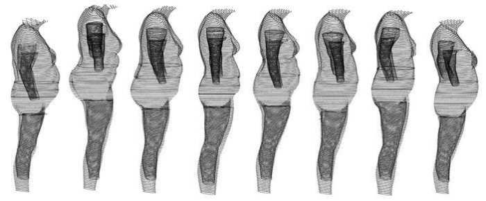 Each of these women have a BMI of 30, yet as you can see, they each are shaped differently, some appear overweight, others look more average, yet all are classified as obese.