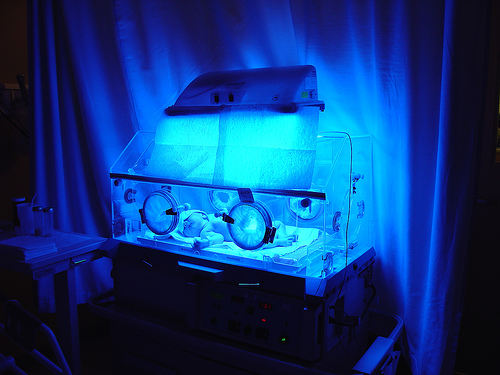 A baby may need to be treated after birth for jaundice, a condition that may be caused by gestational diabetes.