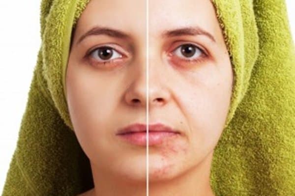 skin whitening creams can be used to lighten skin blemishes but be careful which product you use - and remember there are also alternative treatments