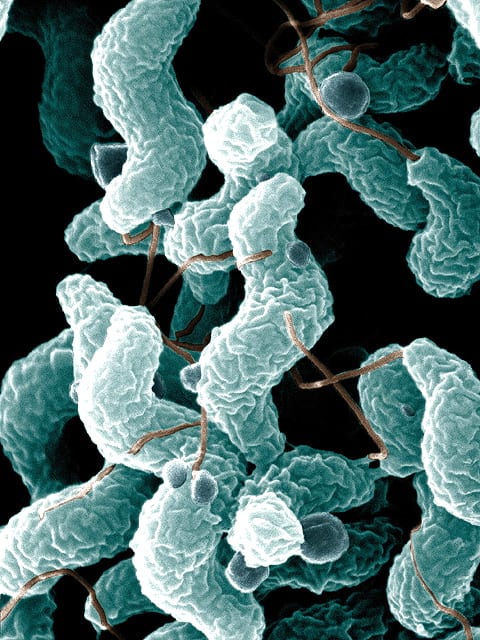 Campylobacter (colourized)