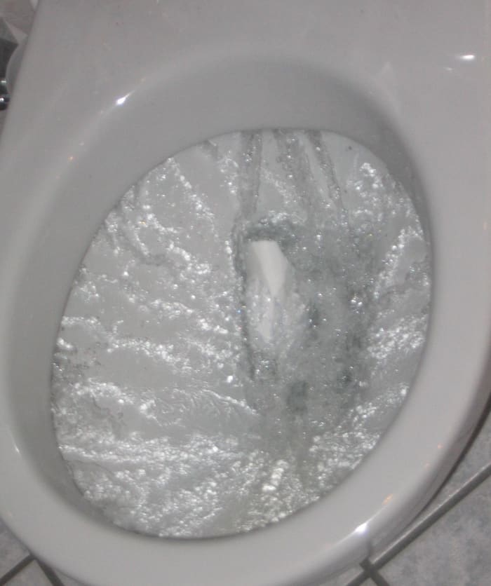 Look before you flush! The appearance of your stool can say a lot about your health.