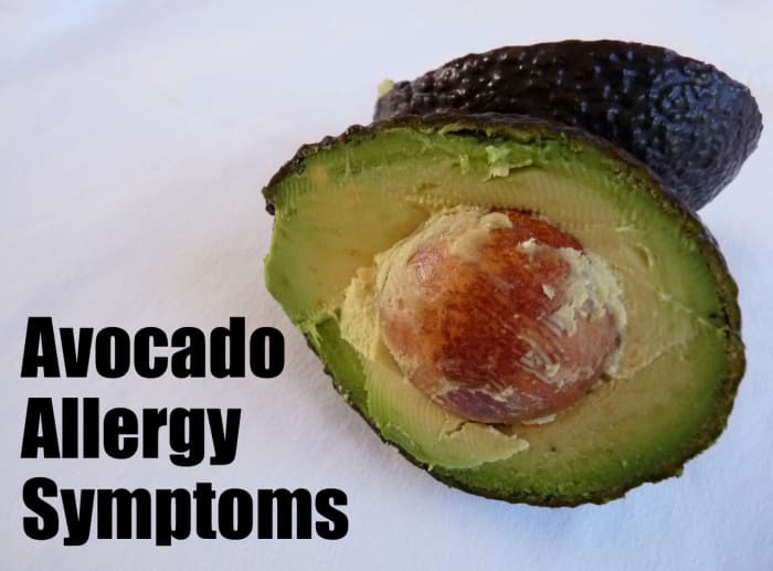 Known as a healthy, super-food for most people, the avocado can cause a variety of allergic reactions in a small percentage of the population.