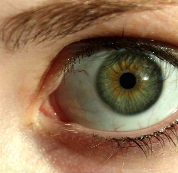 Prominent limbal rings enhance the beauty of the eye.
