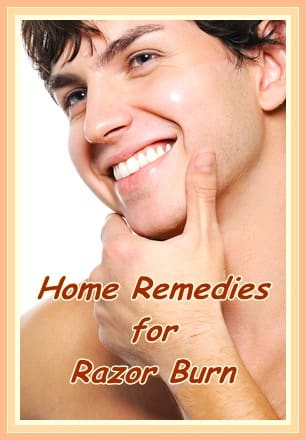 Home remedies and effective treatments for razor burn - plus, how to avoid getting shaving bumps in the first place!