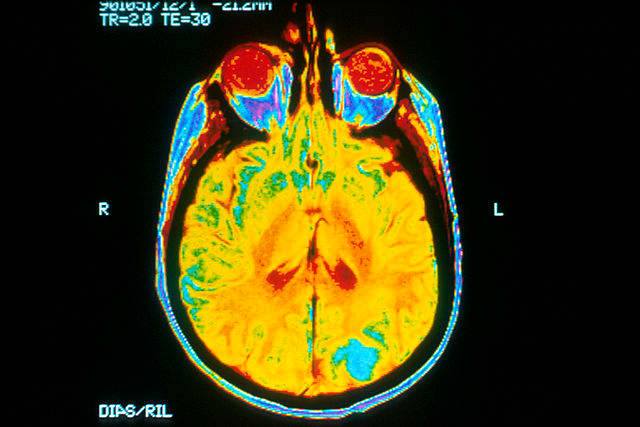 A single image of a human brain using a magnetic resonance imaging (MRI) machine.