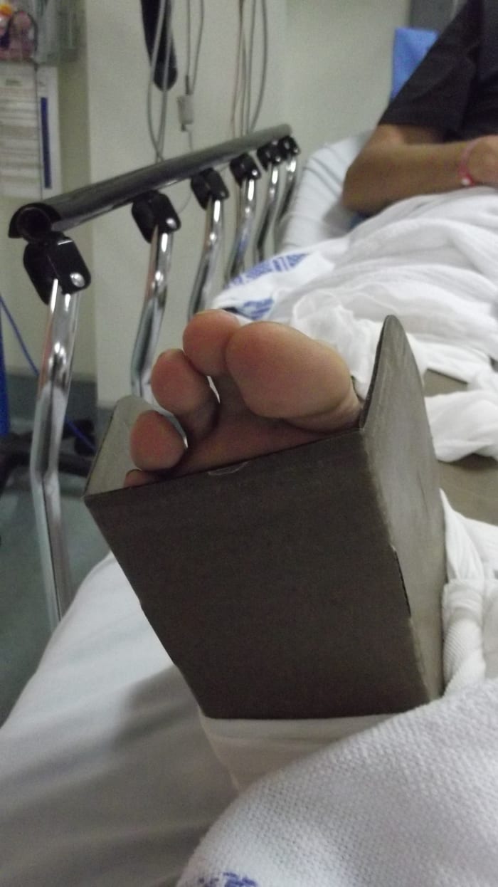 If there is no obvious bone protruding, it can be hard to instantly identify if an ankle is broken or sprained.