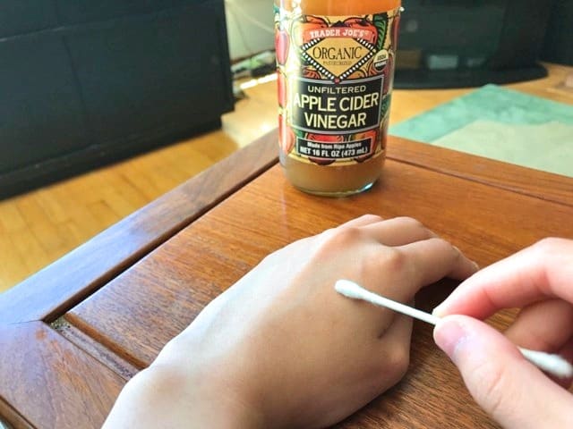 White vinegar works better as a homemade bed bug spray, but apple cider vinegar is better to treat bites.