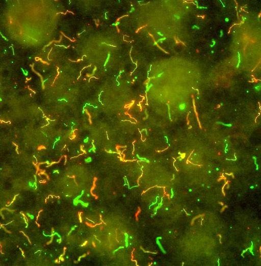 A swarm of Borrelia in their spiral form.