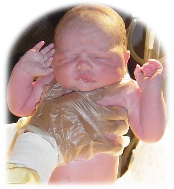 All newborn babies should be monitored for signs of jaundice