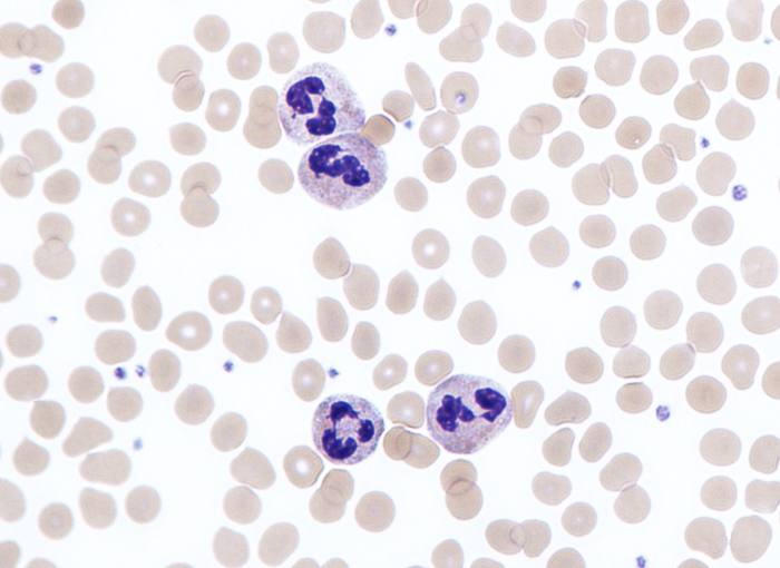 The appendix population of neutrophils (a type of white blood cell) increases significantly during appendicitis. The lobed structure in these stained neutrophils is the nucleus.
