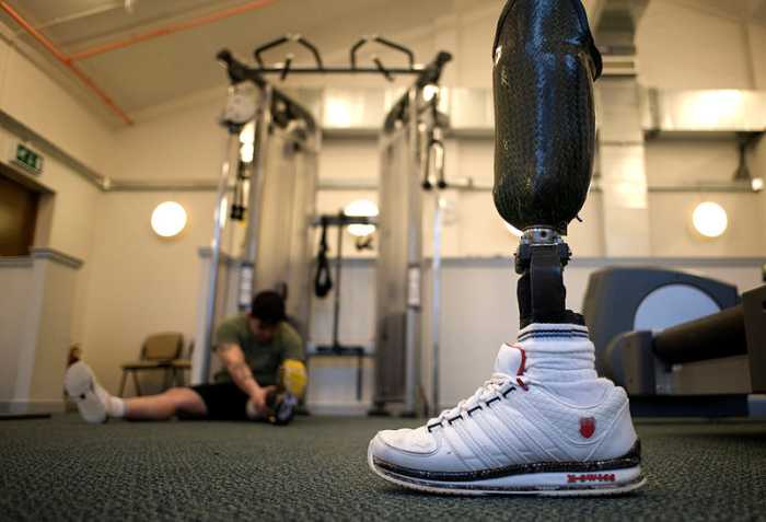 Because of the uncanny valley, roboticist Mashahiro Mori recommends that prostheses be made to look obviously artificial.