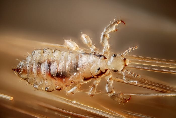 The head louse belongs to the same species as the body louse but is classified in a different subspecies.