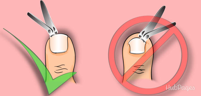 Cut your toenail in a straight line. Attempting to shape your nail by trimming closely to the skin may result in a dangerous cut.