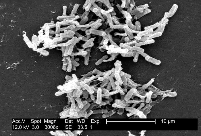 Clostridium difficile cells