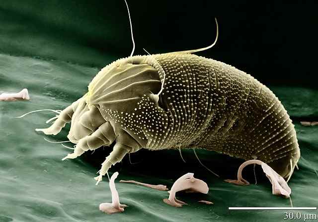 This is a greatly magnified image of a North American House Dust Mite (Dermatophagoides farinae).