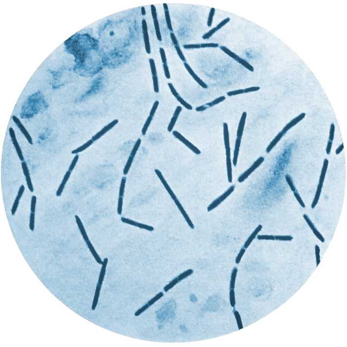 This is a slide of Clostridium septicum stained with methylene blue. The bacterium lives in our gut and can sometimes cause disease.