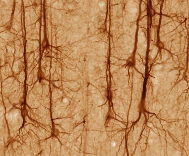 This screenshot shows stained neurons from the cerebral cortex of the brain. Carbon monoxide is found in brain neurons.