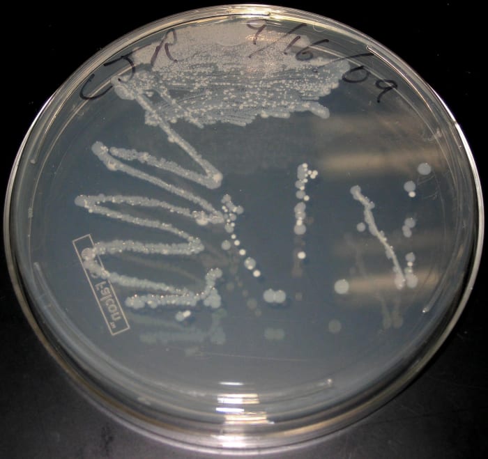 A culture dish containing a number of bacterial colonies resulting from a random sample swab. This is used to illustrate the concept of contracting diseases from snakes, notably Salmonella bacteria (which are commonly associated with animal feces).