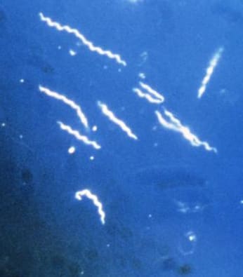 Using darkfield microscopy technique, this photomicrograph, magnified 400x, reveals the presence of several corkscrew-shaped bacteria known as Borrelia burgdorferi