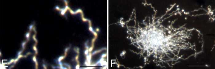 Dark field microscopy images showing the typical spiral form (E) and colony formation (F) of Borrelia burgdorferi