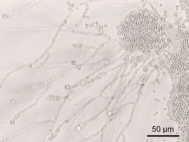 Candida albicans is a fungus that often lives in our gut. It generally exists as single cells but may grow as filaments. It's usually harmless but sometimes causes disease.