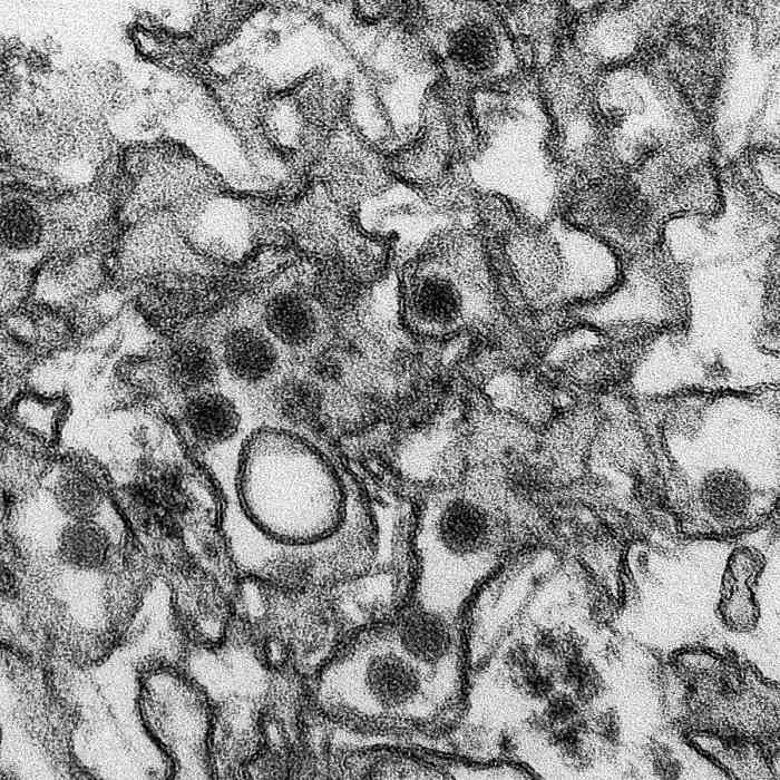 Zika virus (the dark patches)
