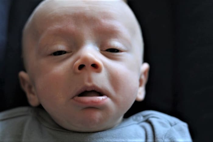 Coughs and sneezes spread diseases. This photo of a baby who is about to sneeze was taken at just the right moment.