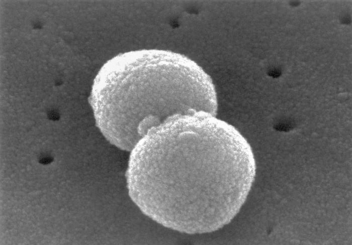 A view of Streptococuus pneumoniae at higher magnification