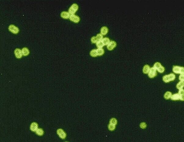 S. pneumoniae often exists as pairs of bacteria known as diplococci. The green coloration in this photo is artificial.