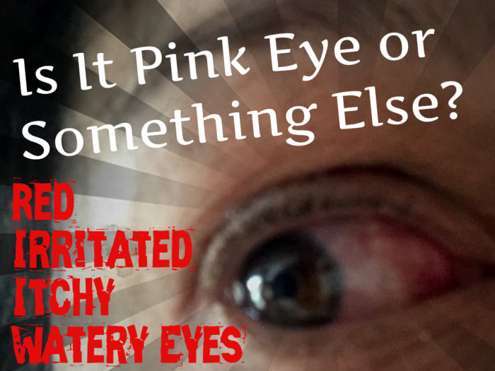 Are your eyes red, irritated, itchy, watery, crusty, and making you miserable? Learn the difference between pink eye, allergies, and more serious medical problems.